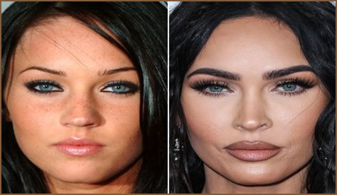Meaghan Jette Martin Plastic Surgery Before and After